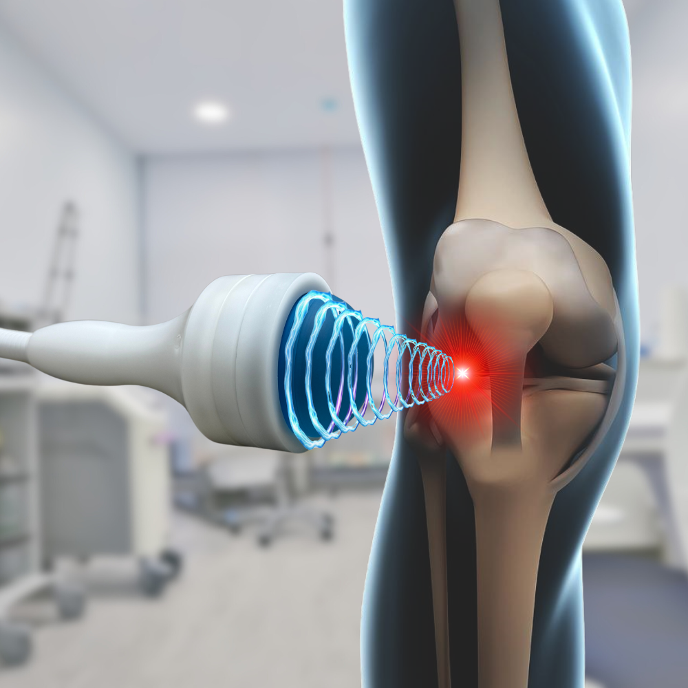 Shockwave Therapy